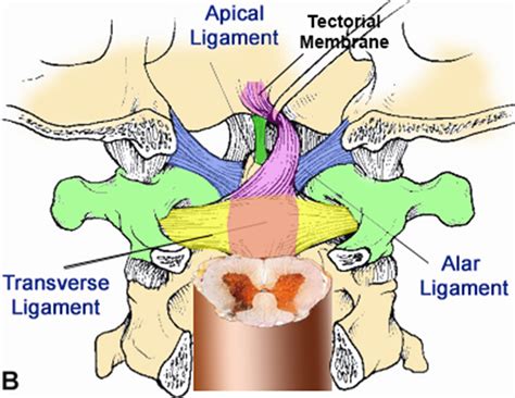 Occipital Condyle Fractures - Spine - Orthobullets