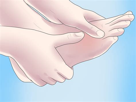 How to Treat a Foot Stress Fracture: 12 Steps (with Pictures)