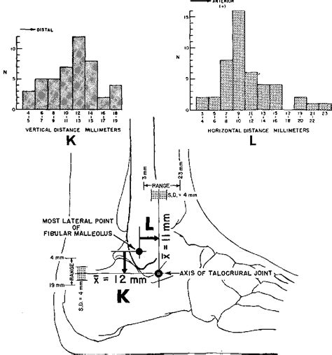 Figure 1 from Anthropometric studies of the human foot and ankle ...