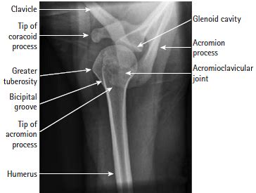 Medical Imaging Technology: Radiographic Anatomy of Shoulder Joint