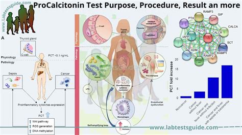 Procalcitonin Test Purpose, Procedure, Result And More | LTG