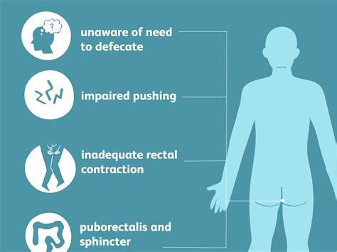 What Causes Pelvic Floor Dyssynergia | Viewfloor.co