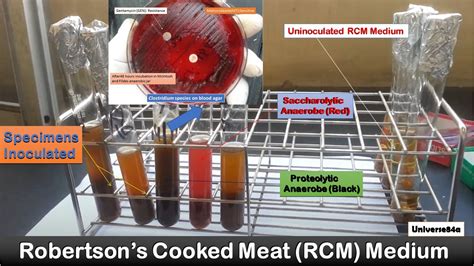 Anaerobic Bacteria Cultivation: Introduction, Principle, Procedure and Res