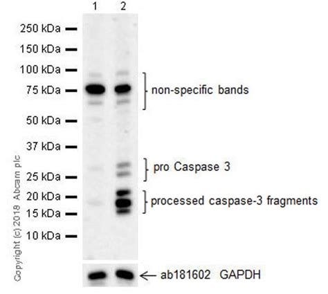 Recombinant Anti-Cleaved Caspase-3 antibody [EPR21032] (ab214430) | Abcam