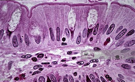 Simple Columnar Epithelium Small Intestine Supporting Connective Tissu ...