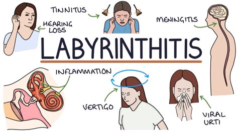 Understanding Labyrinthitis - YouTube