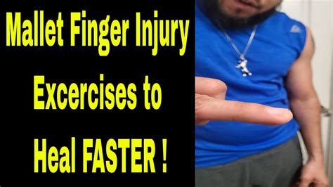 Mallet Finger Injury Exercises Tips Treatment / HEAL FASTER - YouTube