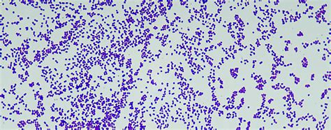 Gram-positive molecular pathogenesis | Faculty of Medicine | Imperial ...