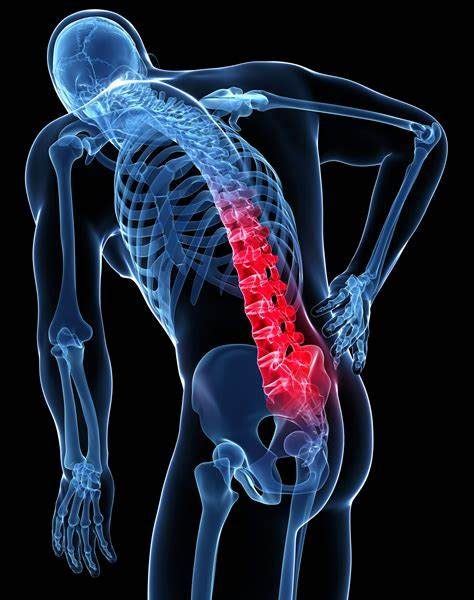 A Guide To Arthritis Back Pain – What is included in the guide!! - Genoa G8