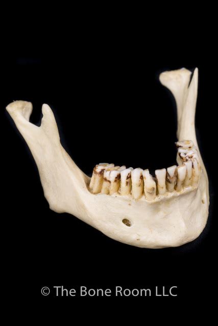 Mandible Anatomy