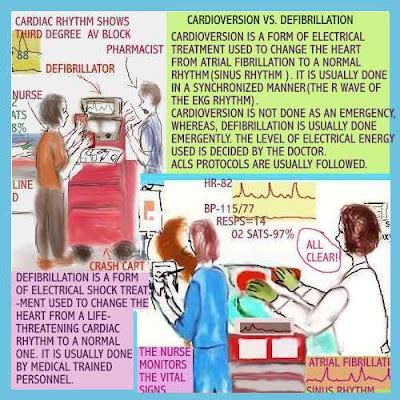 Dear Nurses: CARDIOVERSION VS. DEFIBRILLATION