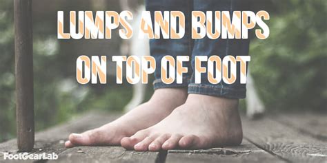 Lumps and Bumps on Top of Foot: Causes, Symptoms, and Treatment