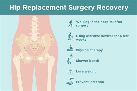 Hip Replacement Recovery: Tips from Doctors and Patients