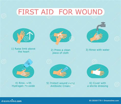 First Aid Treatment for Wound on Skin. Emergency Situation, Bleeding ...