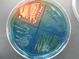 IMG_2961 | Hektoen Enteric Agar. Selects for tolerance to bi… | Flickr