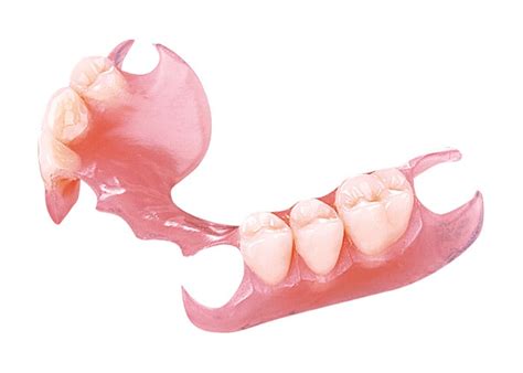 Valplast® Partial Denture - Elite Dental Lab