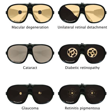 Age simulation suit GERT - Simulation glasses