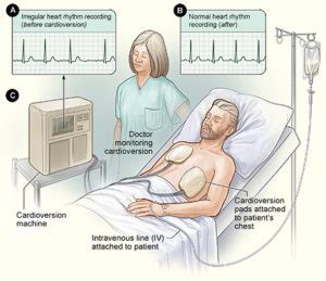 Cardioversion - Baltimore Cardiologists - Woodholme Cardiovascular ...