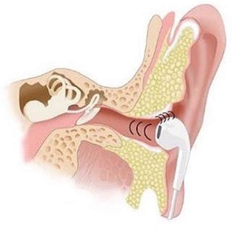 Ear wax removal near me - gadgetsvast