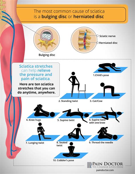 Exercise For Sciatic Nerve In Leg - Exercise Poster