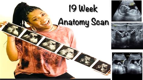 19 Week Ultrasound | Anatomy Scan | Vlog - YouTube