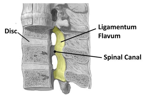 Ligamentum Flavum Cervical Spine