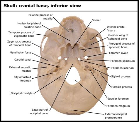 Skull: cranial base, inferior view