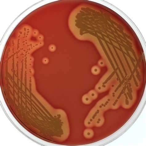 Staphylococcus Aureus Blood Agar Plate