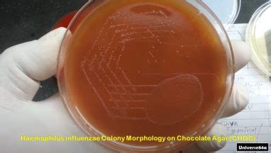 Chocolate Agar (CHOC): Introduction, Principle, Composition,Preparation