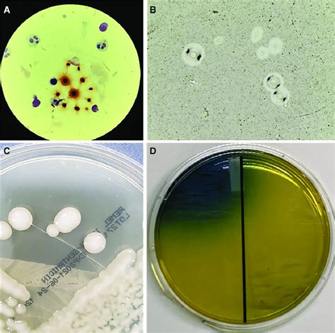 Microscopic and macroscopic pictures of Cryptococcus gattii. (A) Gram ...