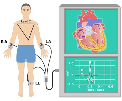 The Electrocardiogram (EKG or ECG): animation and diagram | GetBodySmart