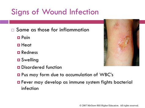 Ppt Bloodborne Pathogens Universal Precautions And Wound Care 24156 ...