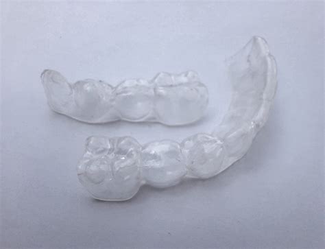 Retainer Replacement: Do You Need It and What's the Cost?