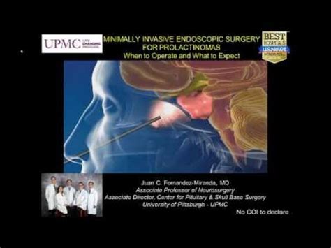 Minimally Invasive Endoscopic Surgery for Prolactinomas - YouTube