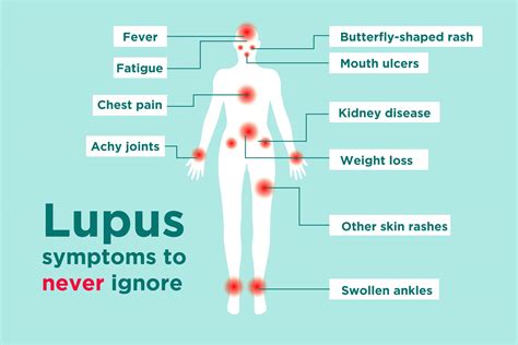 Lupus Signs and Symptoms: How to Tell If You Could Have Lupus