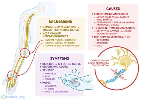 Mononeuropathy: What Is It, Causes, Treatment, and More