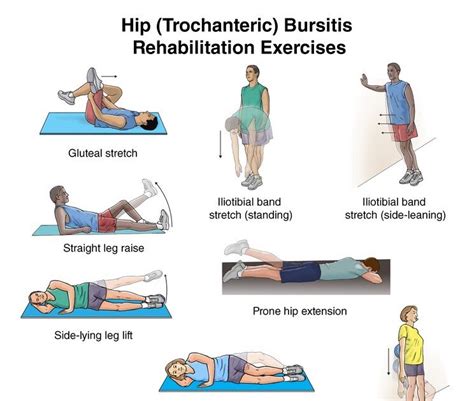 Exercise for Hip Bursitis - Mobile Physiotherapy Clinic