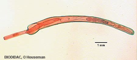 Acanthocephala