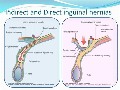 PPT - The anterolateral abdominal wall and peritoneum PowerPoint ...