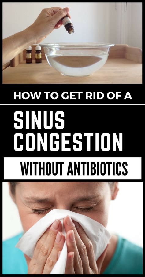 How to get rid of a Sinus Congestion without Antibiotics | Sinus ...