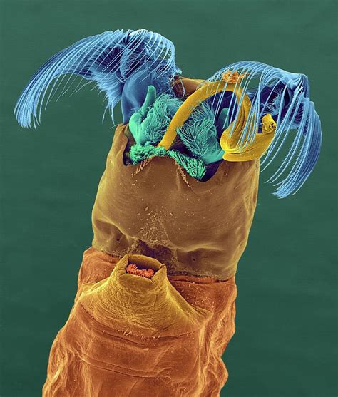 Black Fly Larva Photograph by Dennis Kunkel Microscopy/science Photo ...