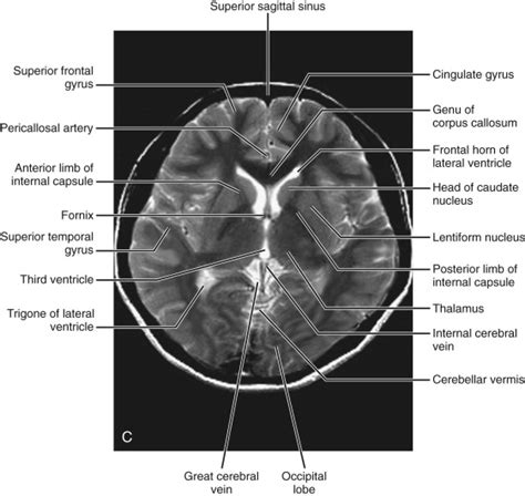 Normal Anatomy | Radiology Key