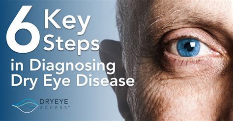 Diagnosing Dry Eye Disease: Where to Start - Dry Eye Access