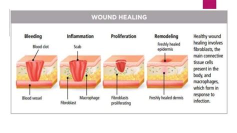 5 Types Of Wound Debridement