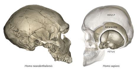 Neanderthal genes influence modern human skull shape — Science ...