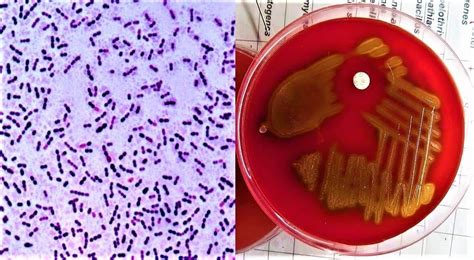 MORPHOLOGY AND CULTURE CHARACTERISTICS OF STREPTOCOCCUS PNEUMONIAE ...