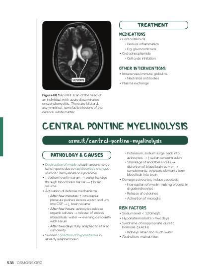 Central pontine myelinolysis: Video, Causes, & Meaning | Osmosis