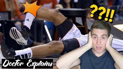 KEVIN WARE INJURY | Doctor Explains Infamous Basketball Injury - YouTube