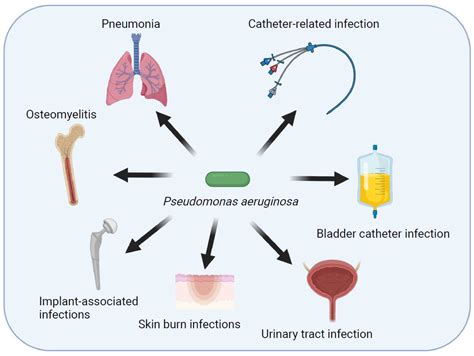 Pathogens | Free Full-Text | Pathogenesis of the Pseudomonas aeruginosa ...