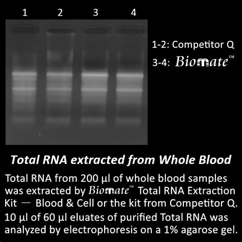 Total RNA Extraction Kit – Blood & Cell